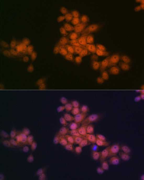 WAPL Rabbit mAb