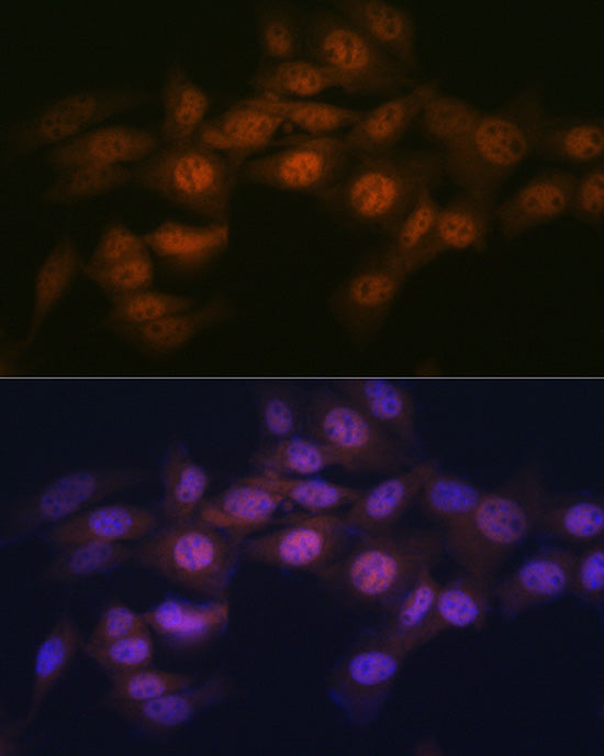 WAPL Rabbit mAb