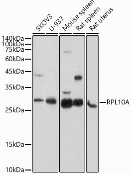 RPL10A Rabbit pAb