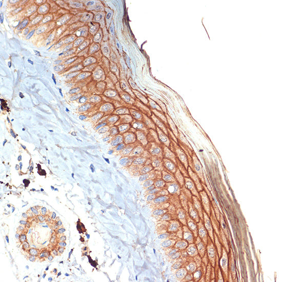 PERP Rabbit mAb