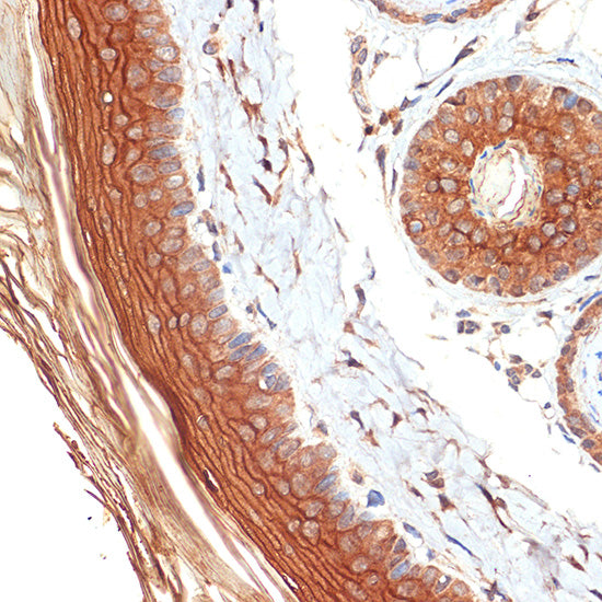 PERP Rabbit mAb