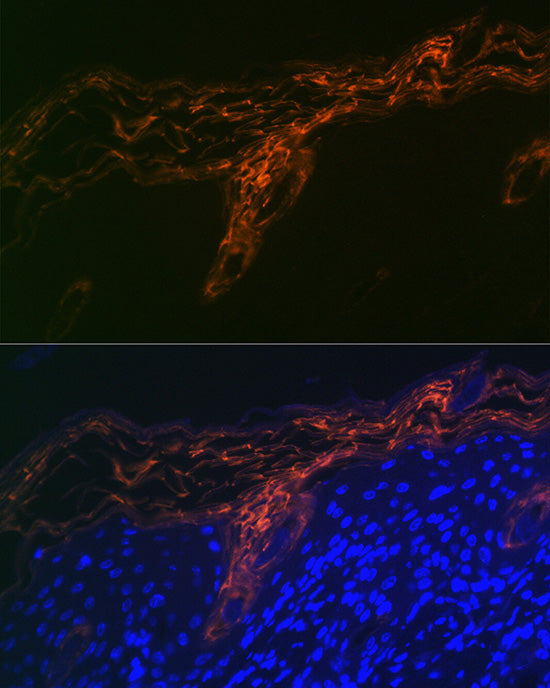 PERP Rabbit mAb