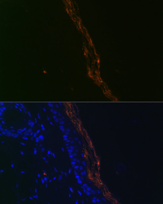 PERP Rabbit mAb