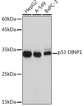 p53 DINP1 Rabbit mAb