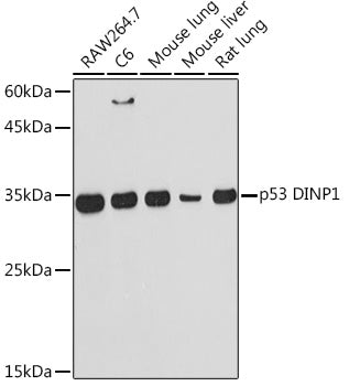 p53 DINP1 Rabbit mAb