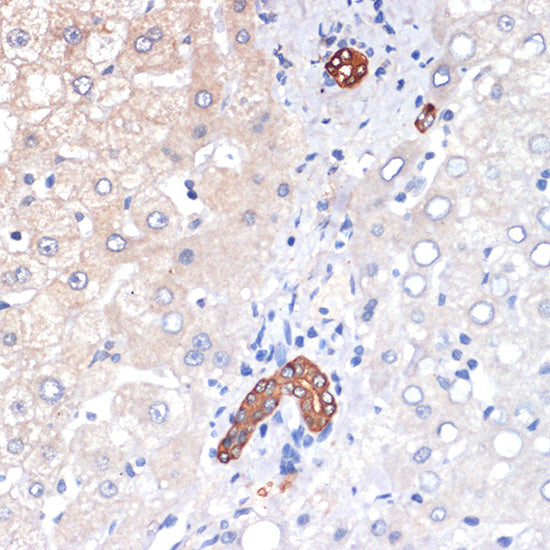 p53 DINP1 Rabbit mAb