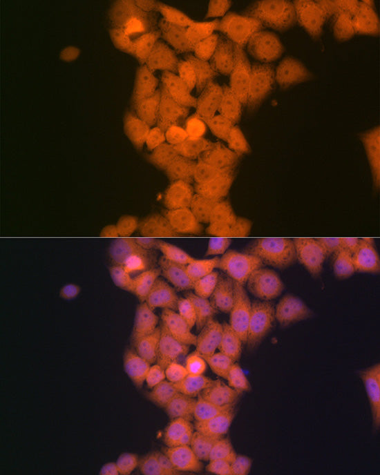 p53 DINP1 Rabbit mAb