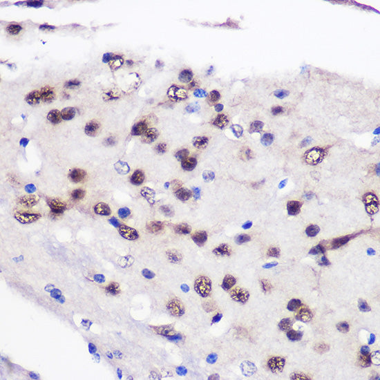 CELF1 Rabbit pAb