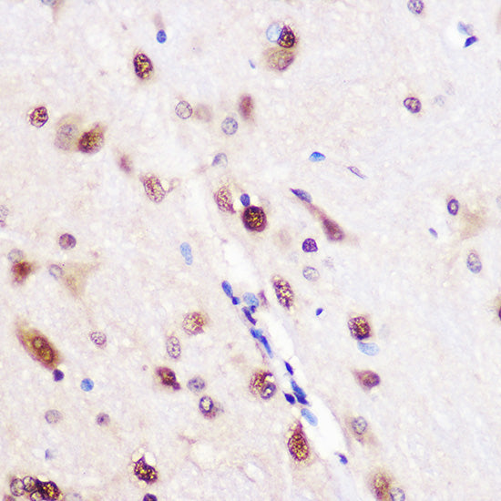 CELF1 Rabbit pAb