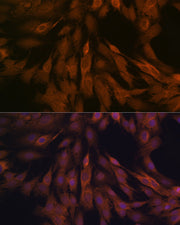 ULK3 Rabbit mAb