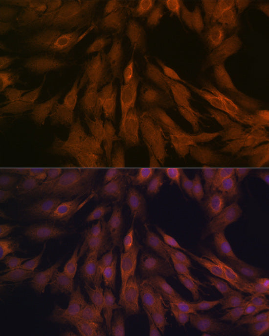 ULK3 Rabbit mAb