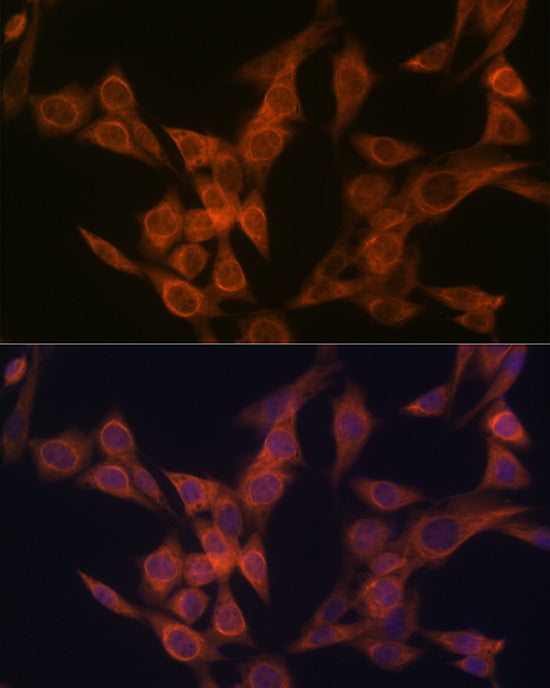 ULK3 Rabbit mAb