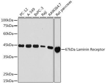 67kDa Laminin Receptor Rabbit mAb