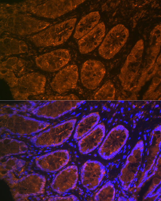 CEACAM6 Rabbit mAb