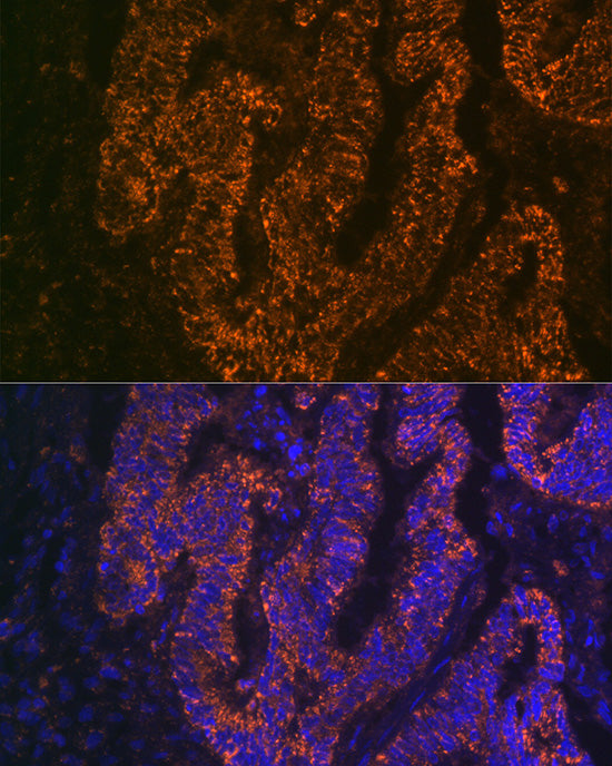 CEACAM6 Rabbit mAb