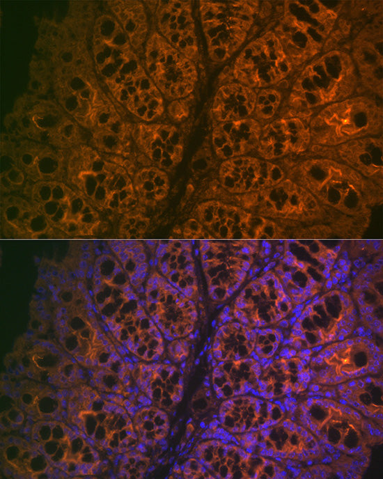 CEACAM6 Rabbit mAb