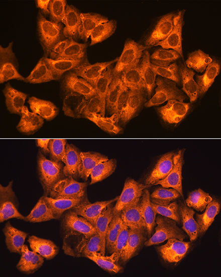 ZCCHC11 Rabbit pAb