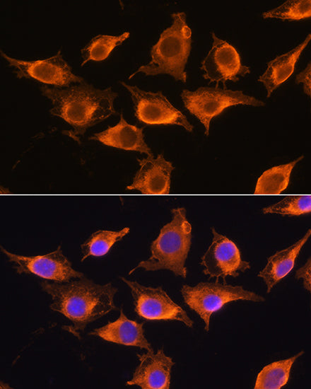 ZCCHC11 Rabbit pAb