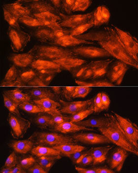 ZCCHC11 Rabbit pAb