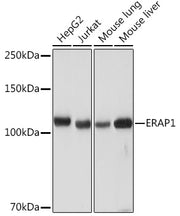 ERAP1 Rabbit mAb