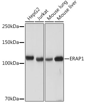 ERAP1 Rabbit mAb