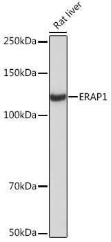 ERAP1 Rabbit mAb