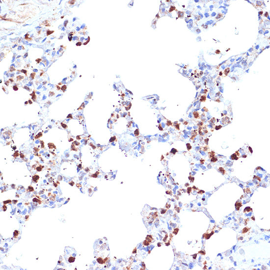 ERAP1 Rabbit mAb