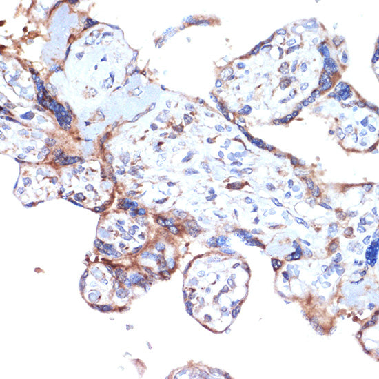 ERAP1 Rabbit mAb