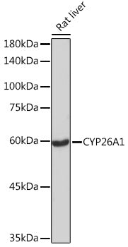 CYP26A1 Rabbit mAb
