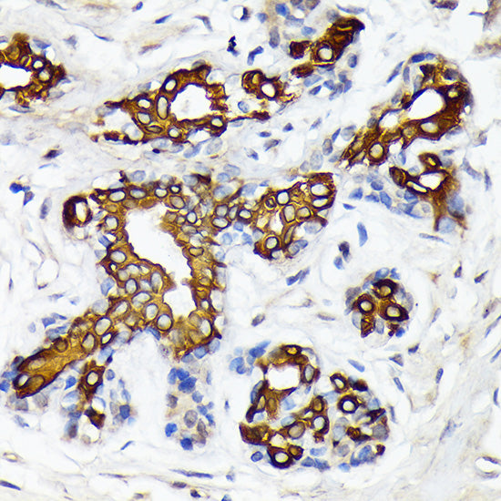 CYP26A1 Rabbit mAb