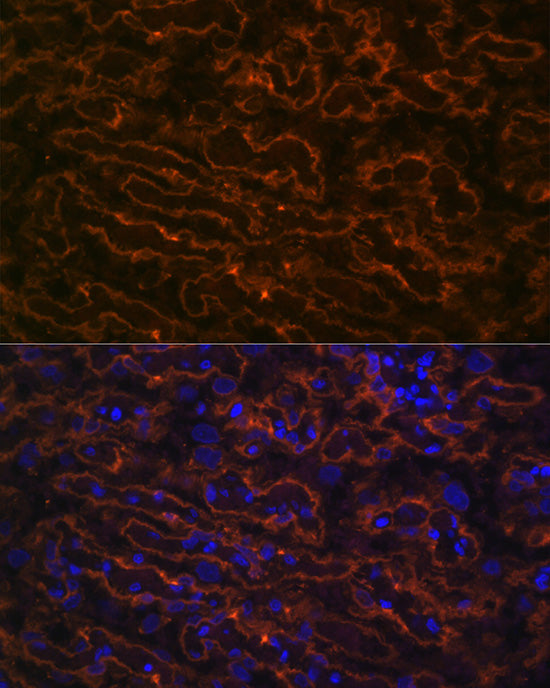 CYP26A1 Rabbit mAb