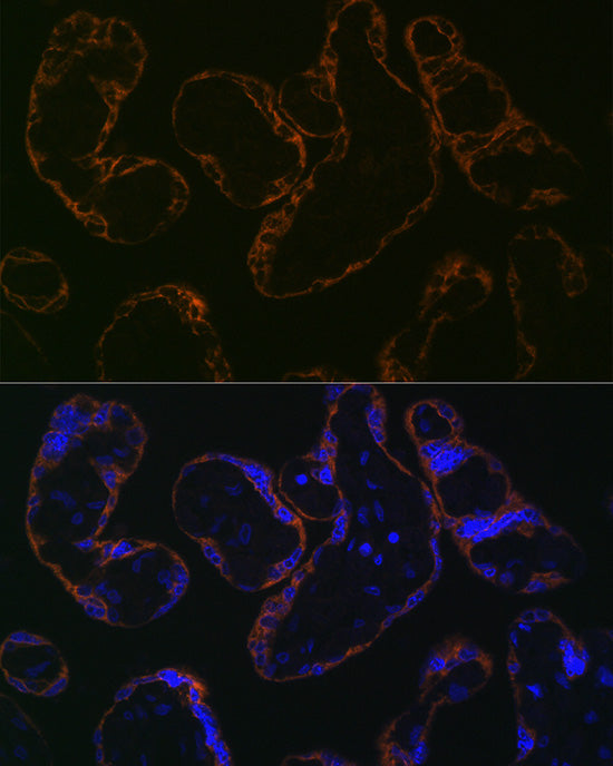 CYP26A1 Rabbit mAb