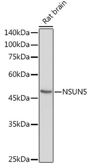 NSUN5 Rabbit pAb