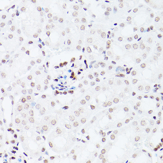 NSUN5 Rabbit pAb