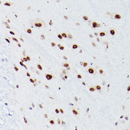 NSUN5 Rabbit pAb
