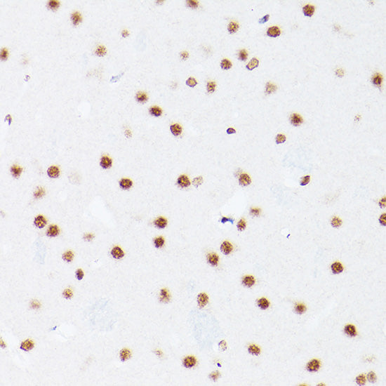 NSUN5 Rabbit pAb