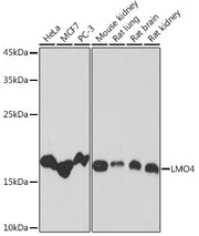 LMO4 Rabbit mAb