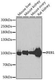 Aconitase 1 (ACO1) Rabbit pAb