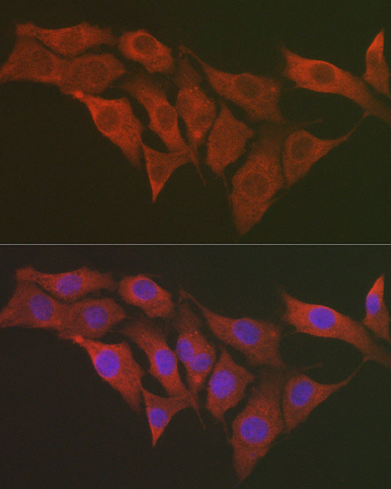 S6 Ribosomal Protein (RPS6) Rabbit pAb