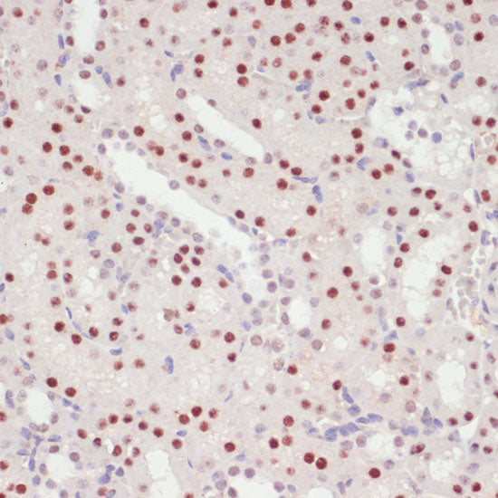 SNRNP70 Rabbit pAb