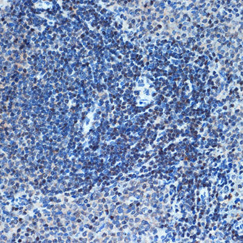 CHD3 Rabbit mAb