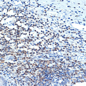 CHD3 Rabbit mAb