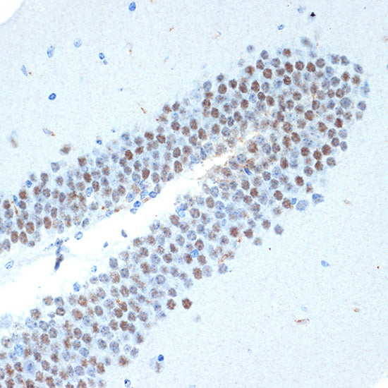 CHD3 Rabbit mAb