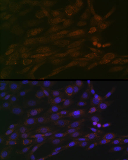 CHD3 Rabbit mAb