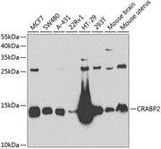 CRABP2 Rabbit pAb