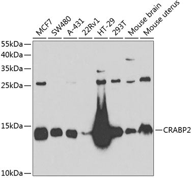 CRABP2 Rabbit pAb