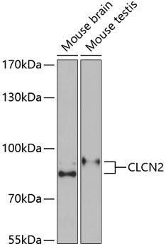 CLCN2 Rabbit pAb