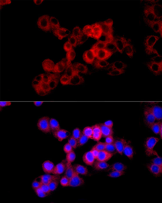 Cystathionase/CTH Rabbit pAb