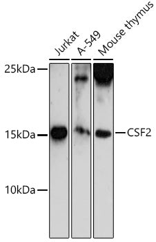 CSF2 Rabbit pAb
