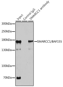 [KO Validated] SMARCC1/BAF155 Rabbit pAb